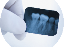 Microscopic root canal treatment